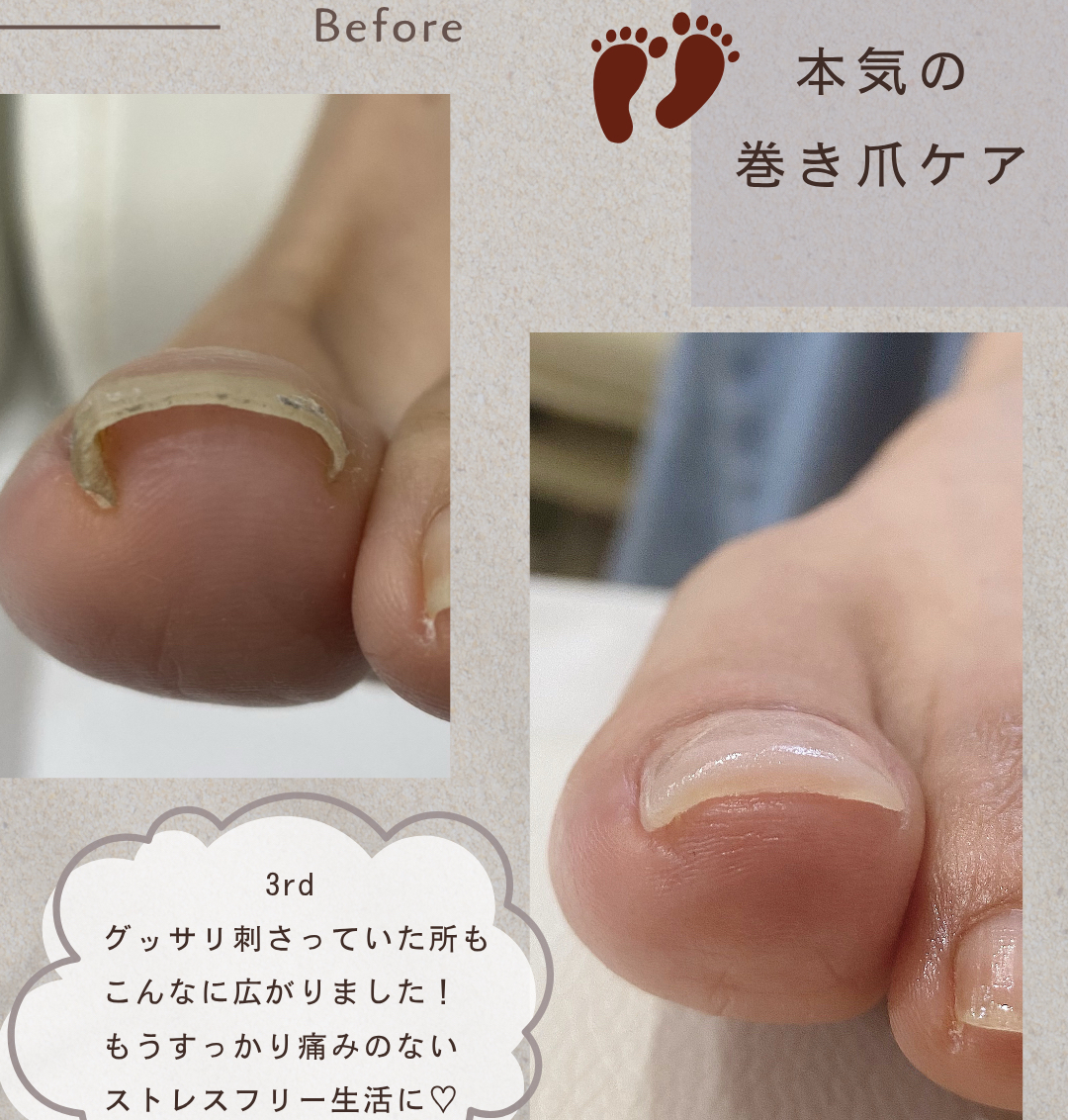 Dia..nail