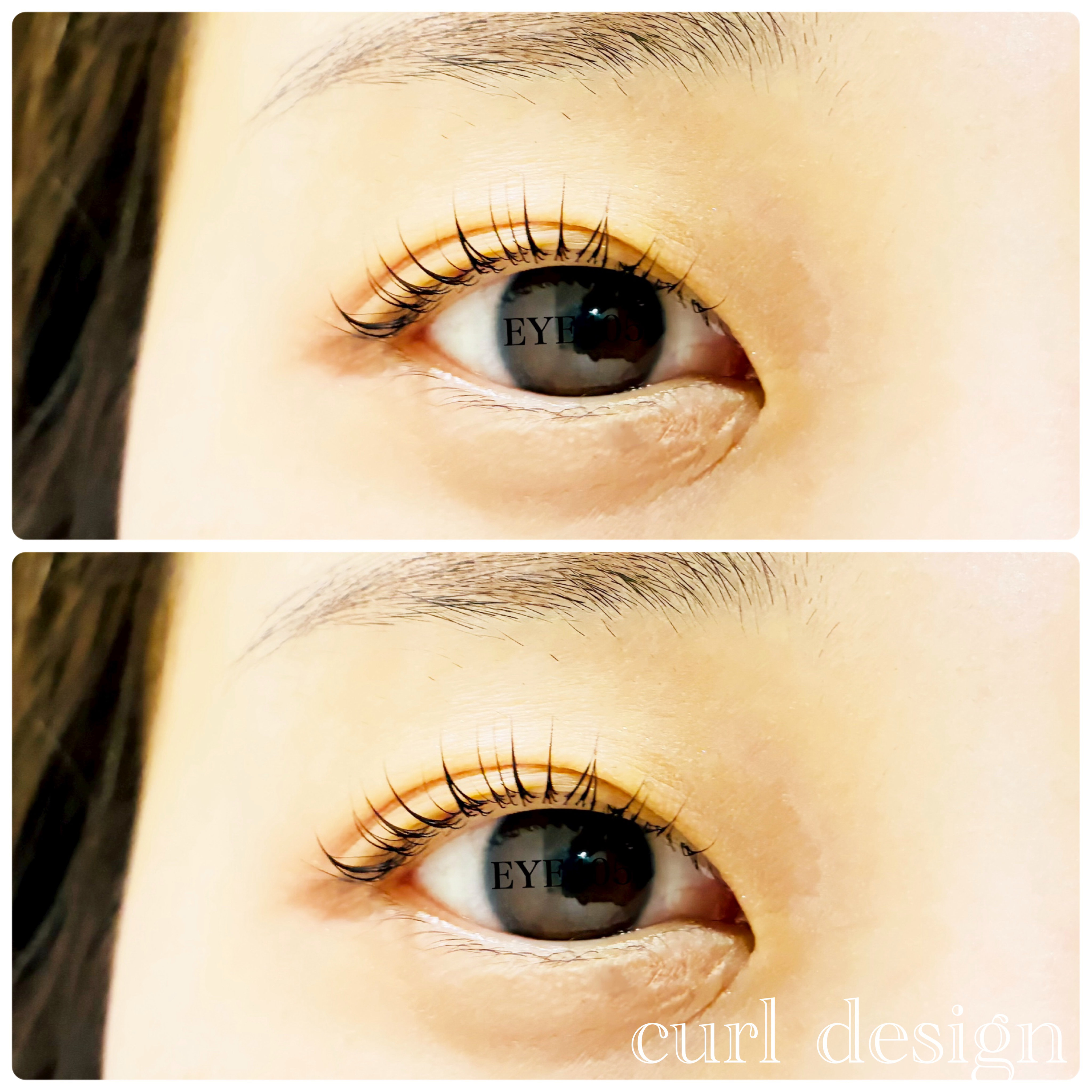 iga_EYE405
