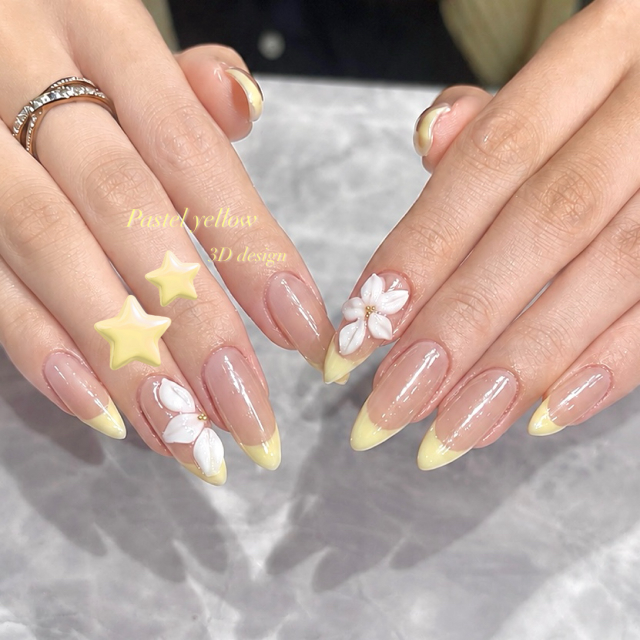fein_rion