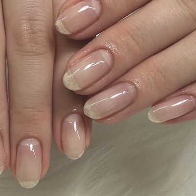 クリアジェル
パラジェル