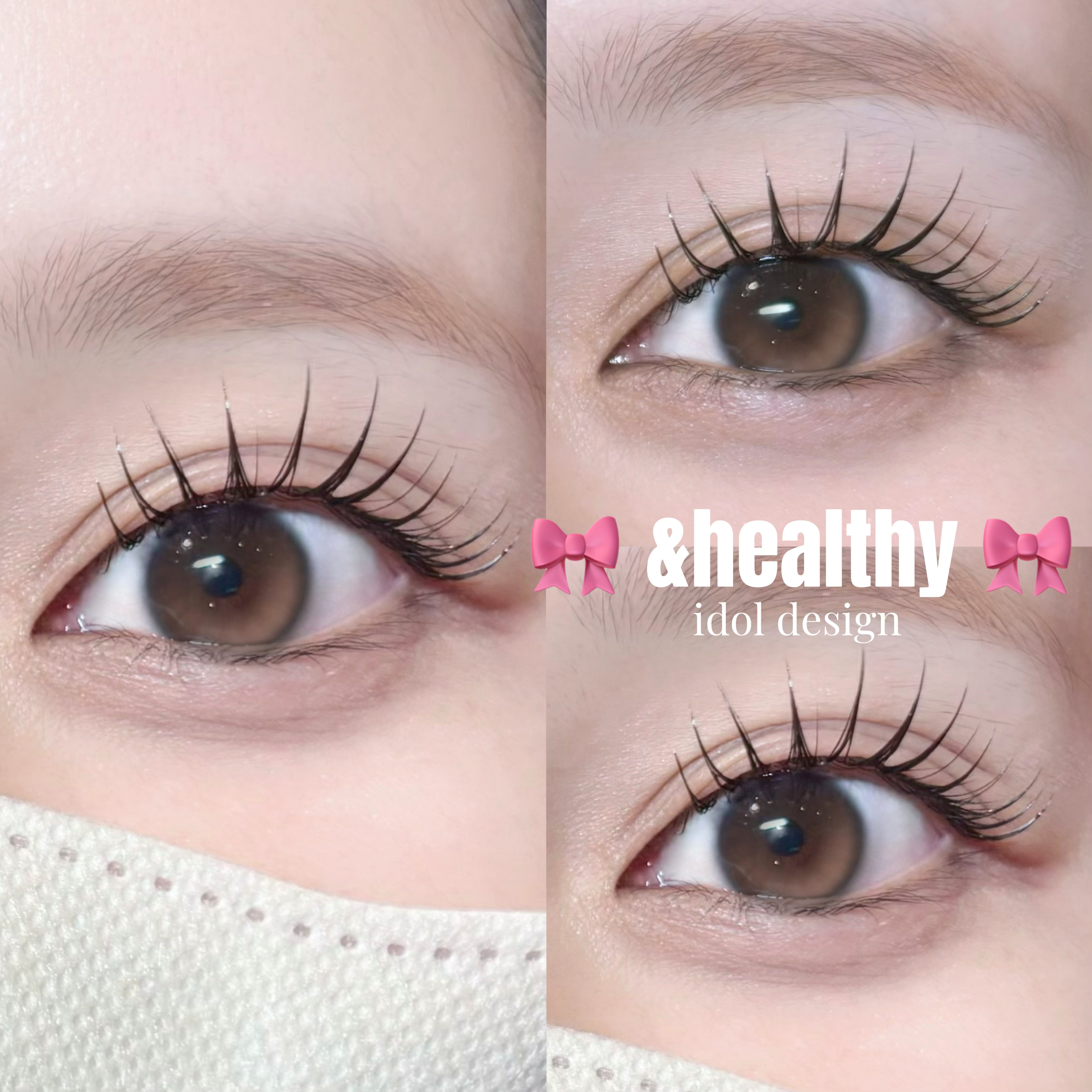 milky__eye
