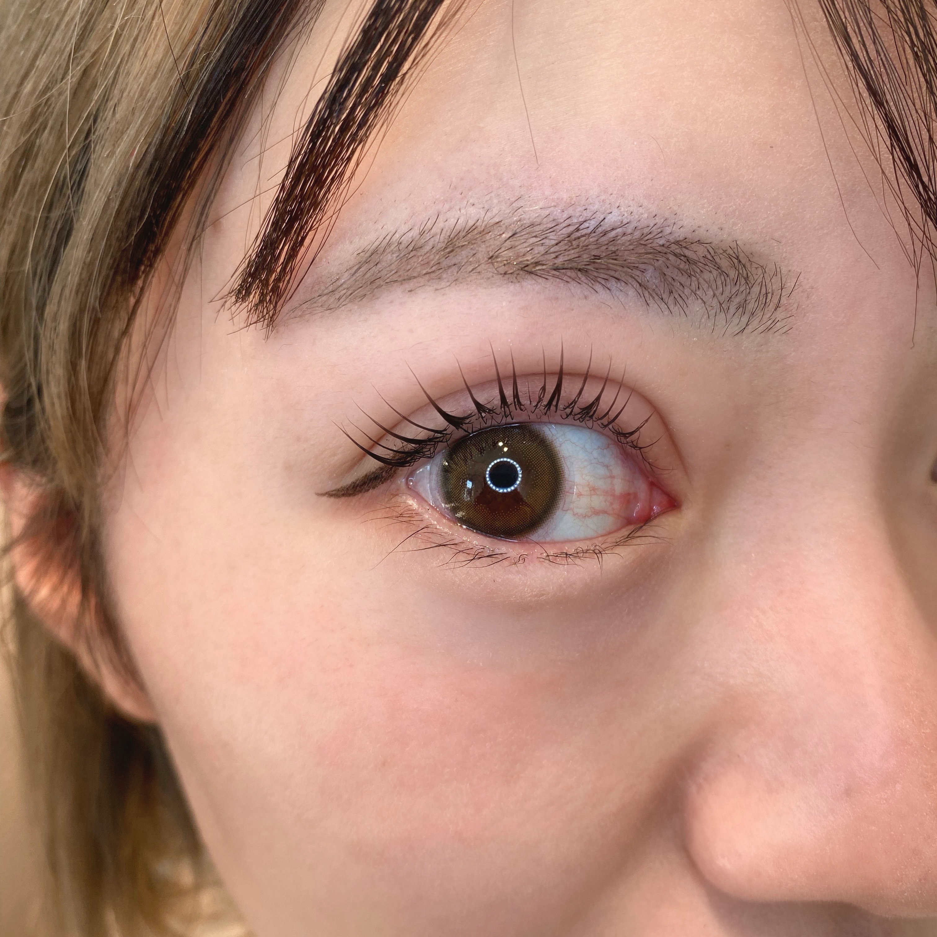 eyelist_aico