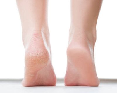 足裏角質ケア＋甘皮ケア