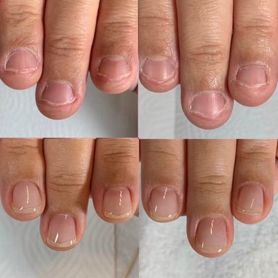 自爪育成モニター【人数限定】