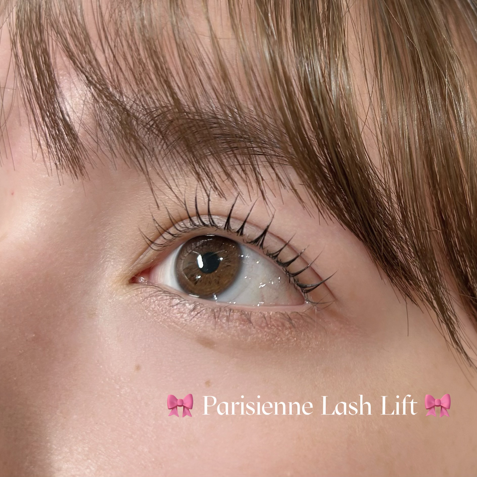mio_trueye