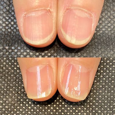 ハンド甘皮ケア