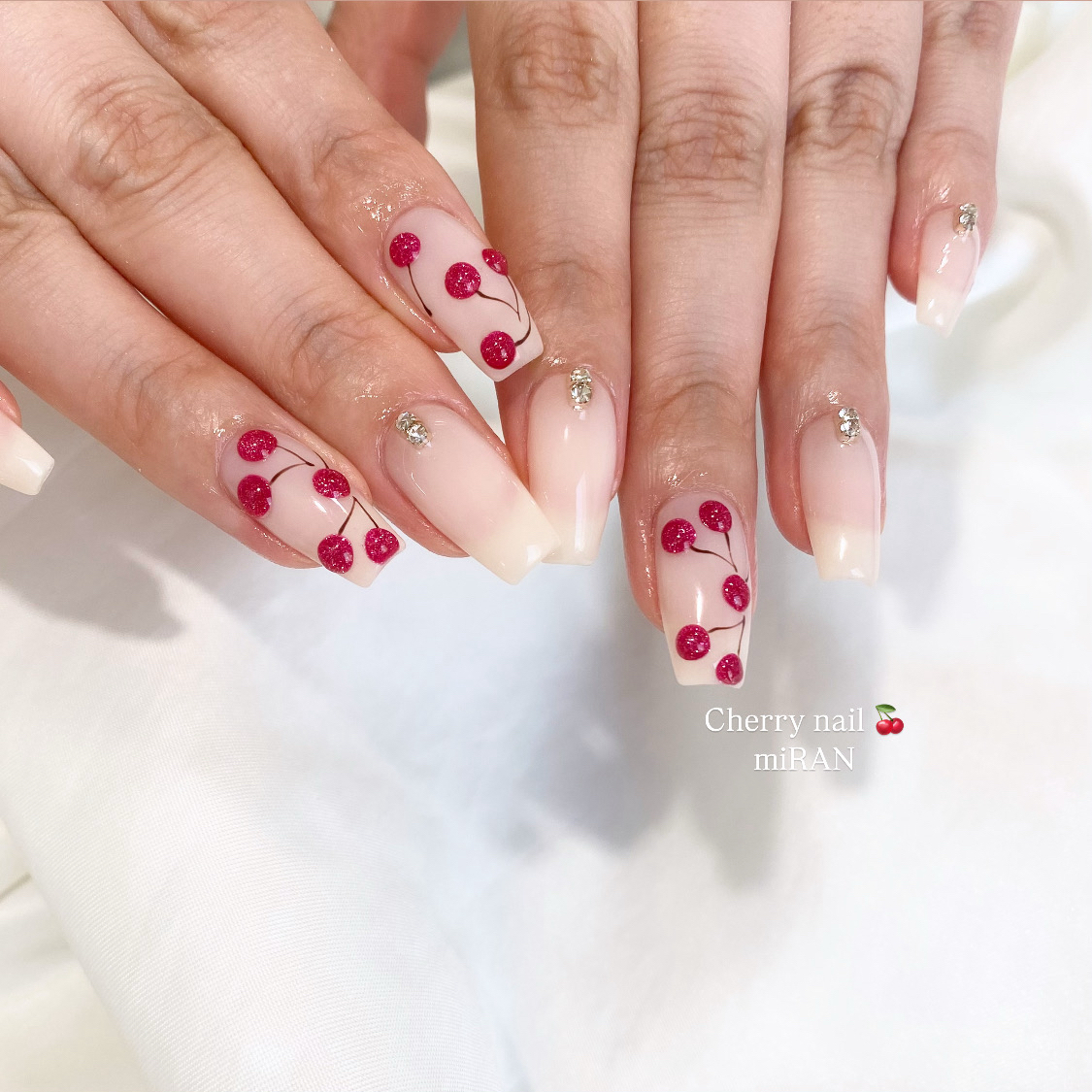 miRAN_nail
