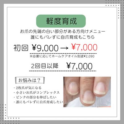(軽度)自爪育成コース ¥9000→¥7000
※ご予約前にメッセージ必須