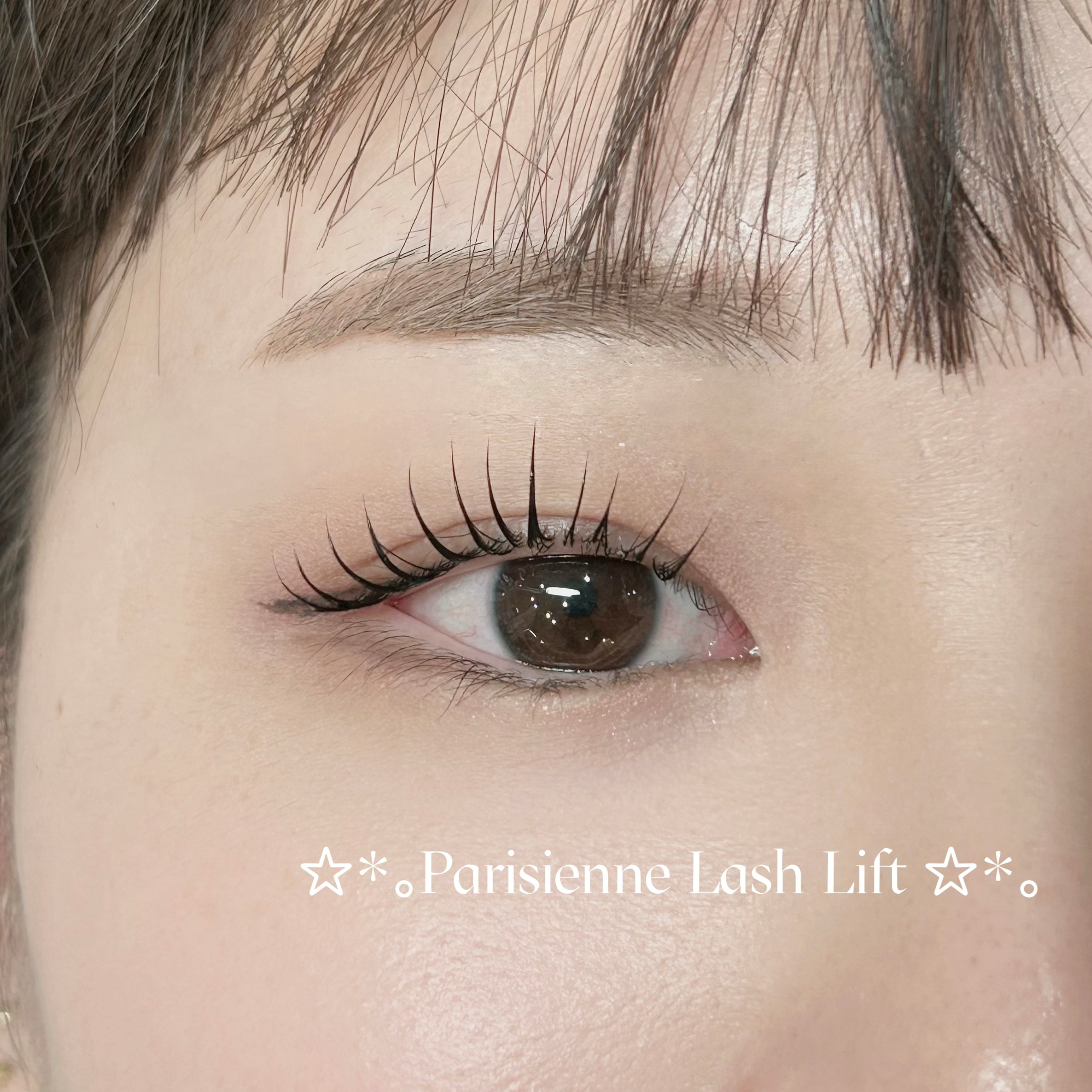 mio_trueye