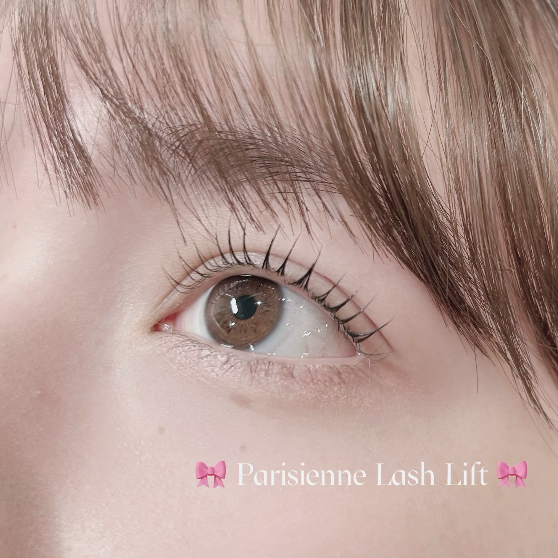 mio_trueye