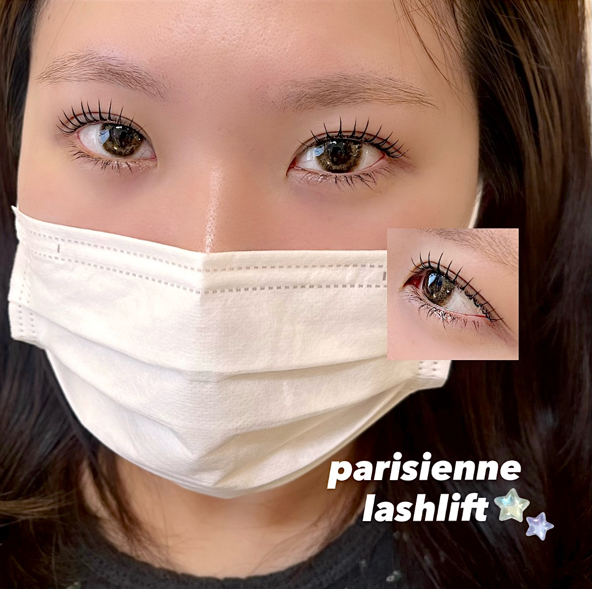 airi_trueye