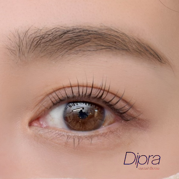 dipra.eye