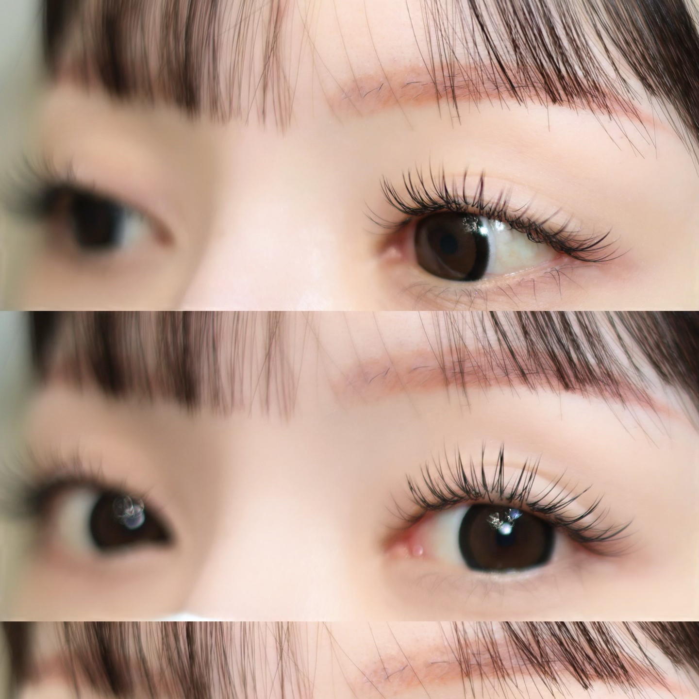dipra.eye