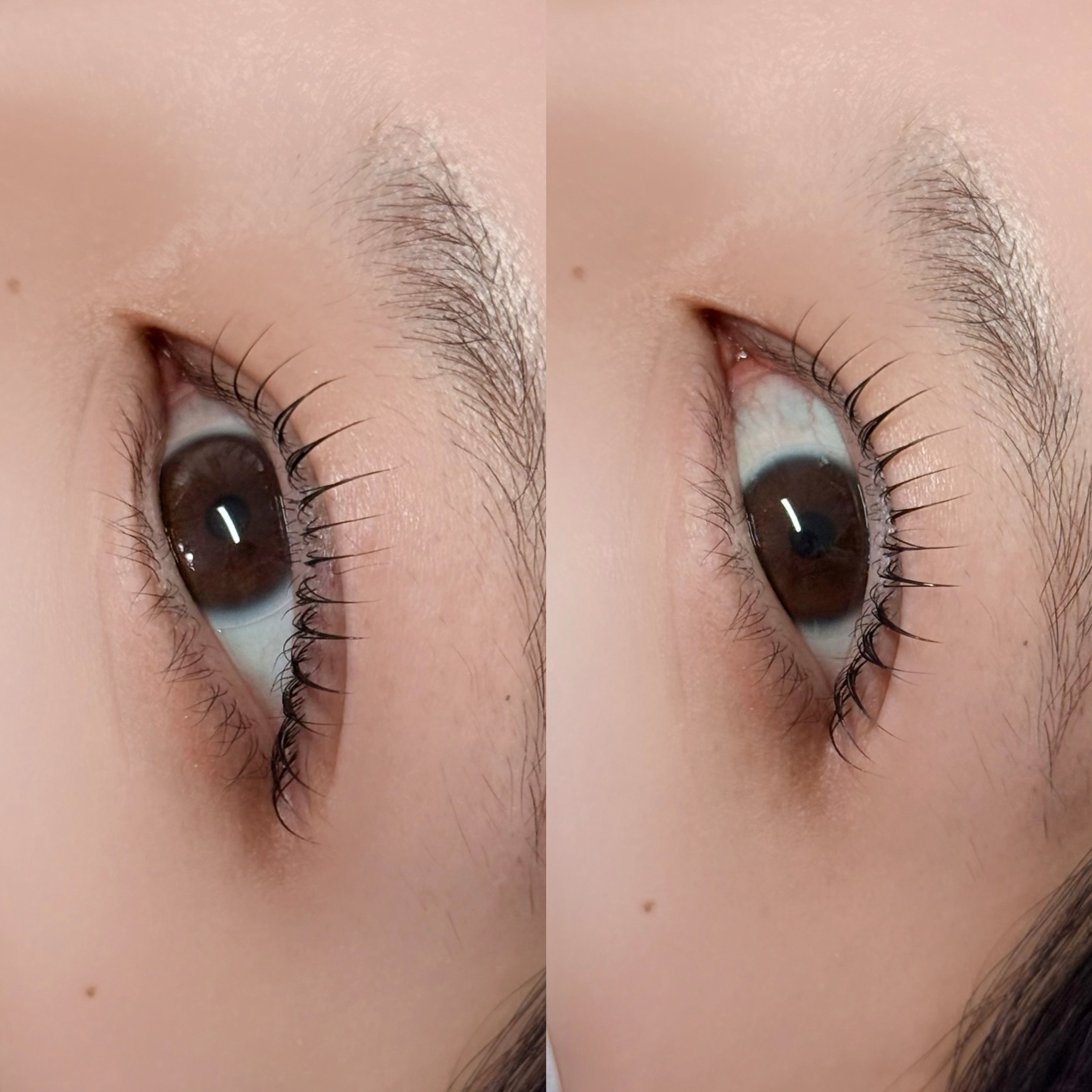 eyeknow