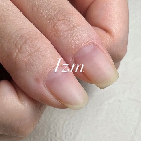 nail_izm
