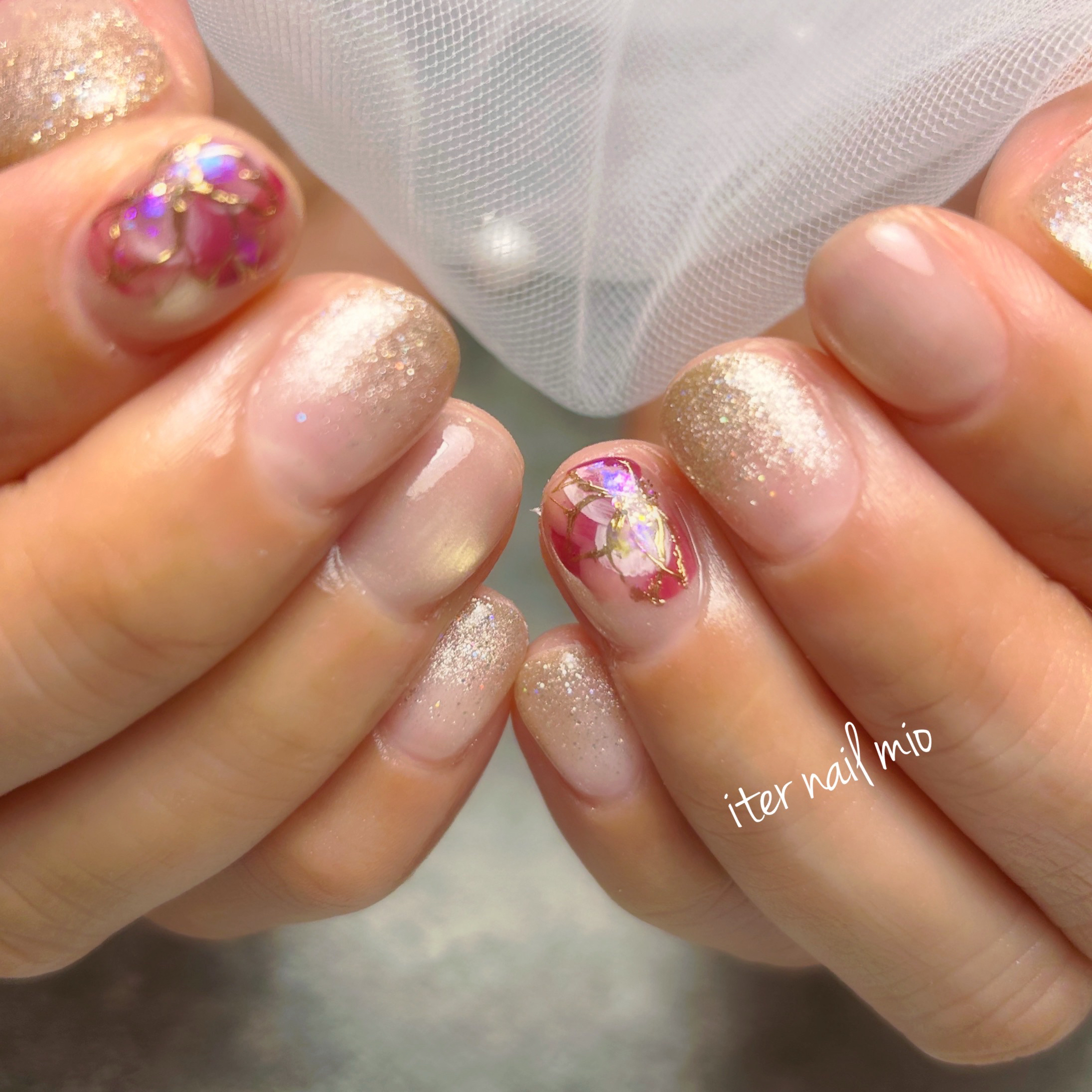 iter_nail_mio