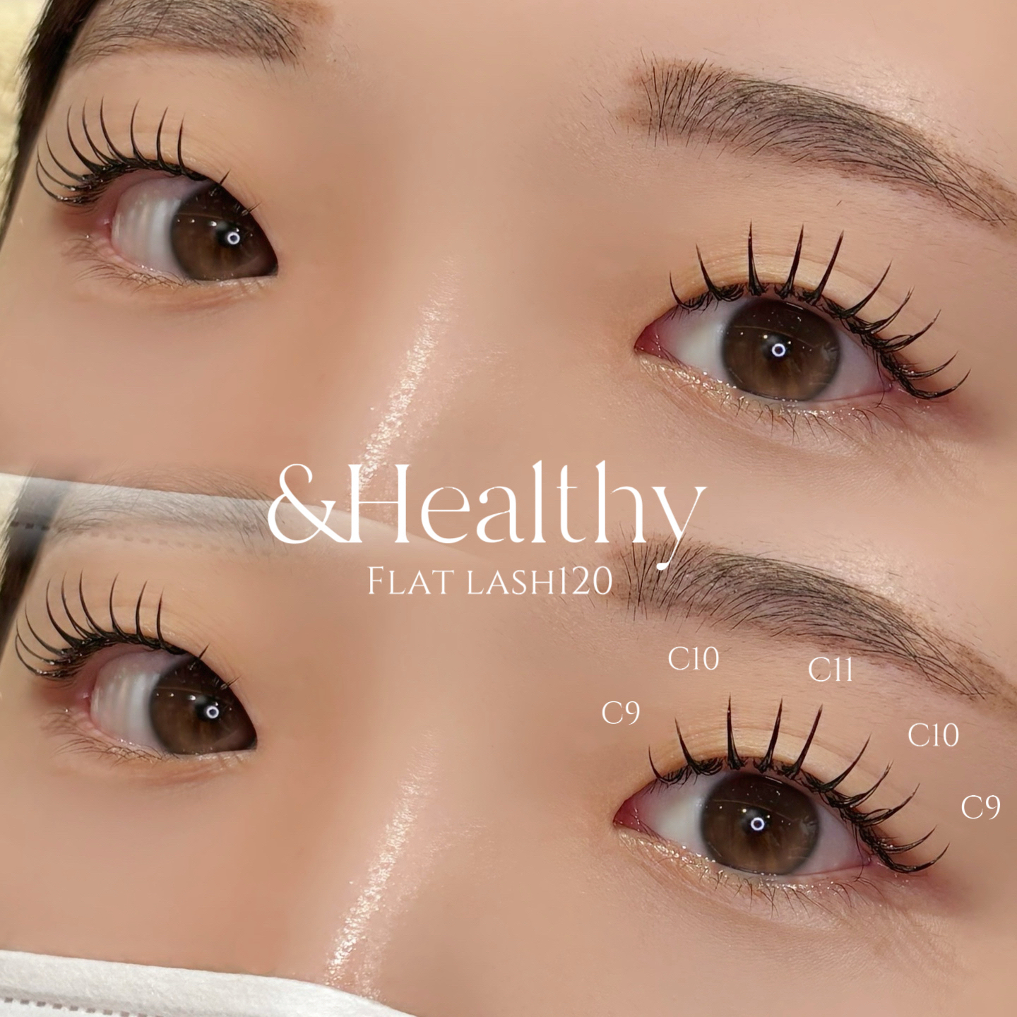 ym_eye_