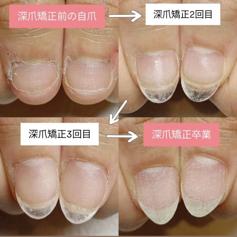 mani_e_nail