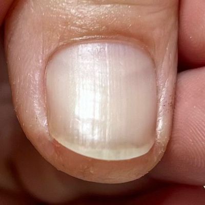 ハンドケア（プロテケアネイル）