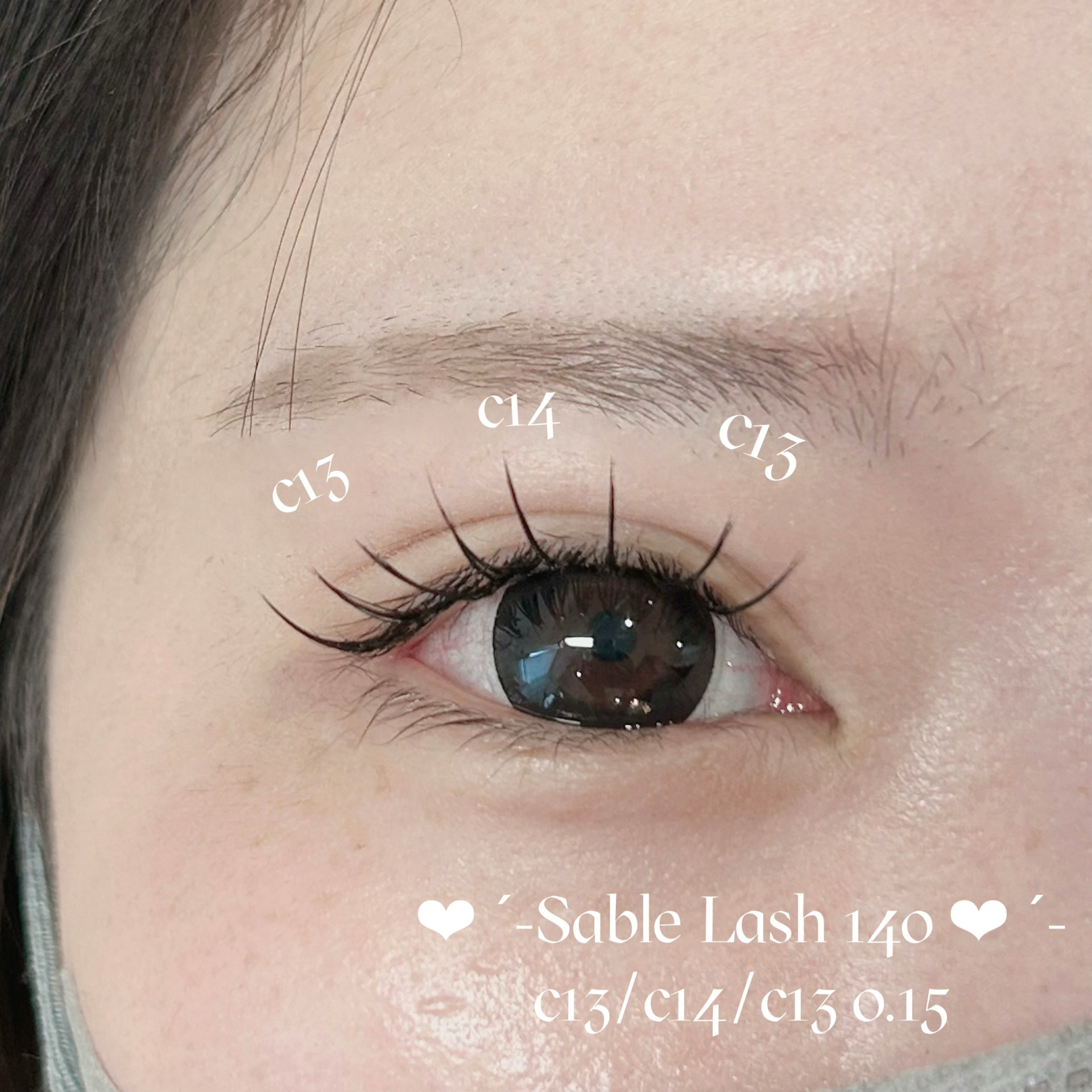 mio_trueye