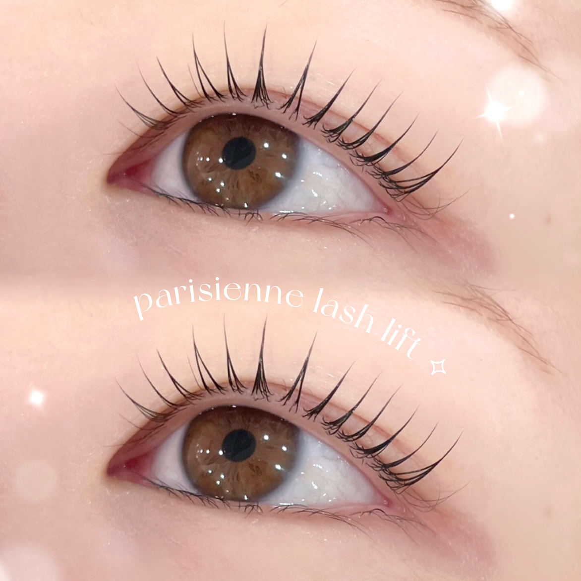 izumi_trueye