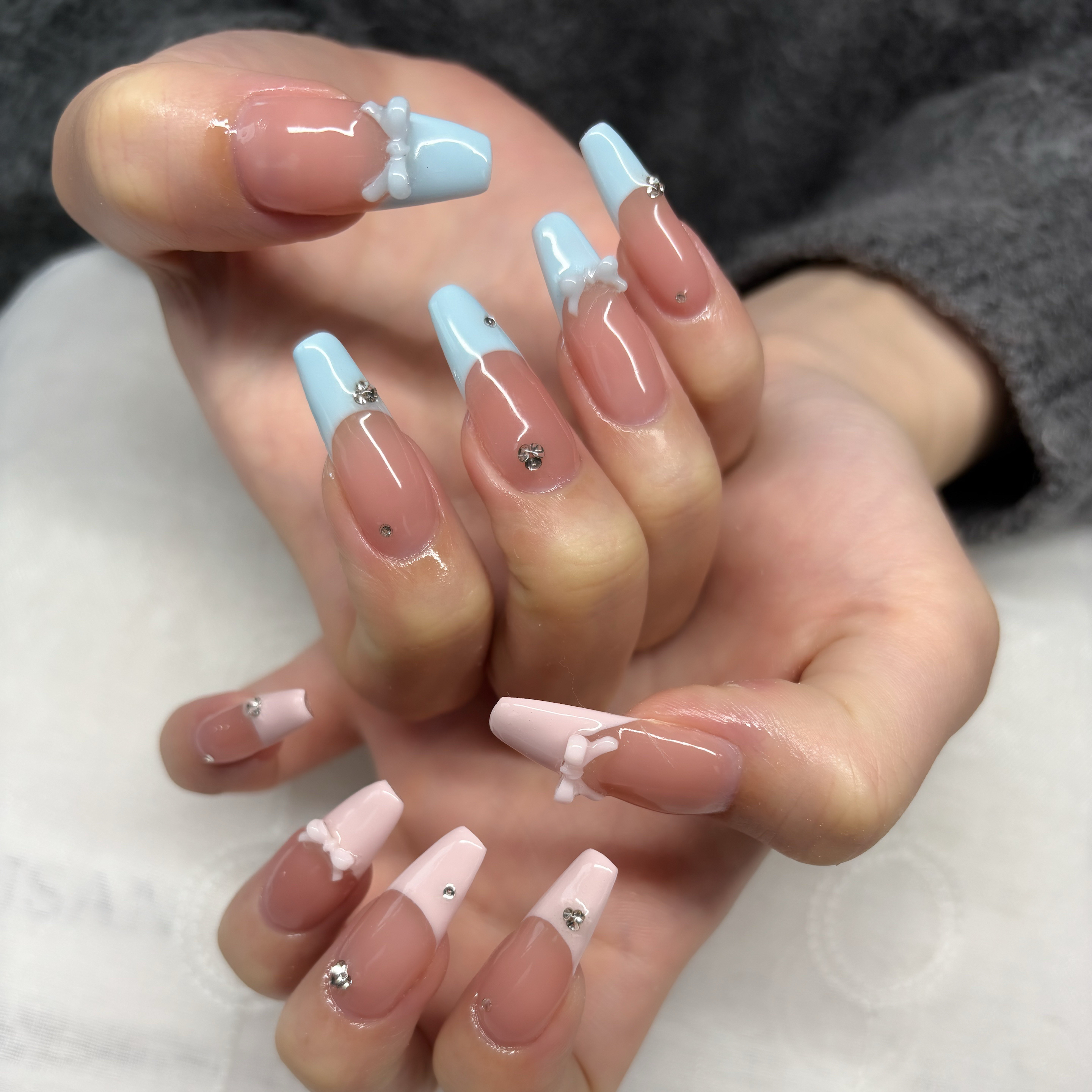 trangnail