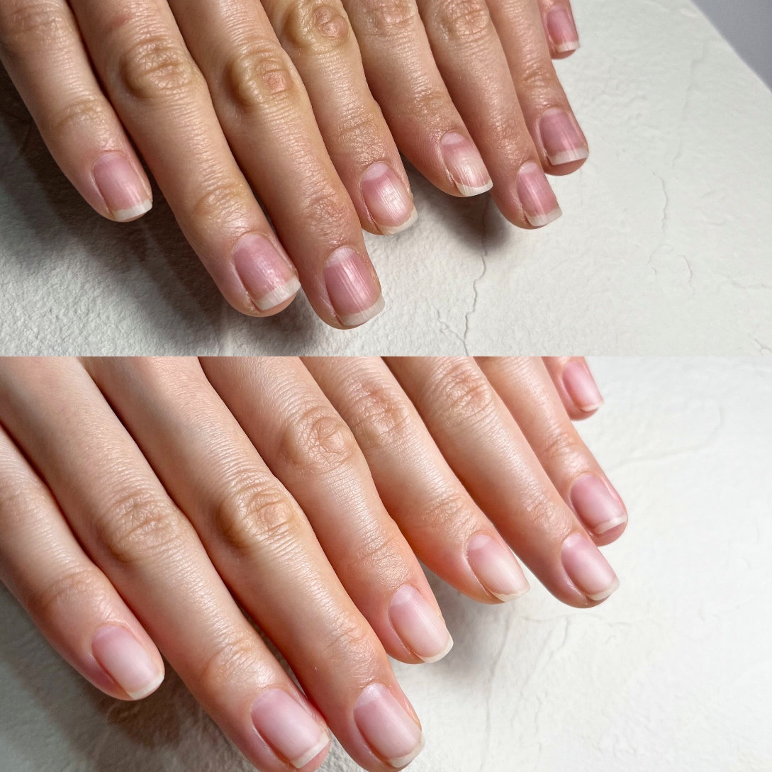 nail_izm