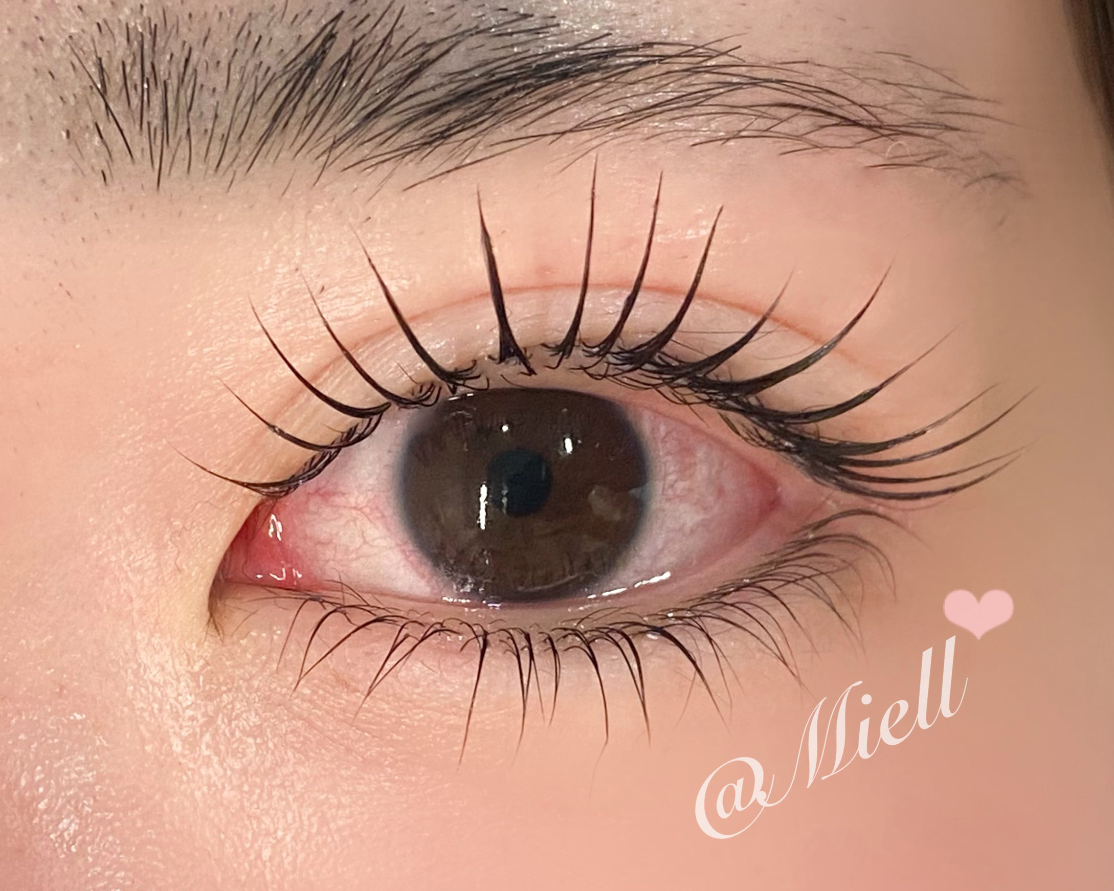MEI_Miell