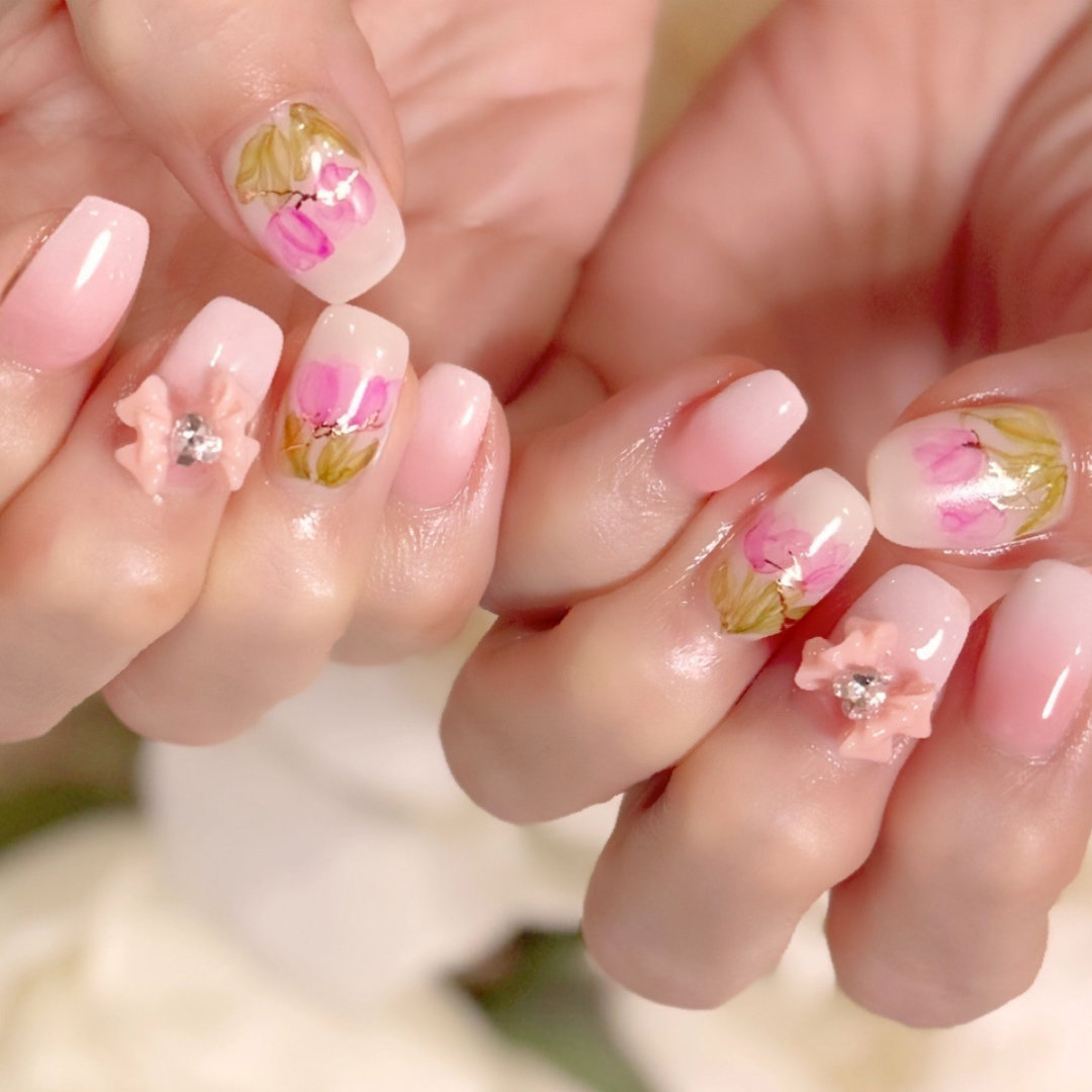 laangenail