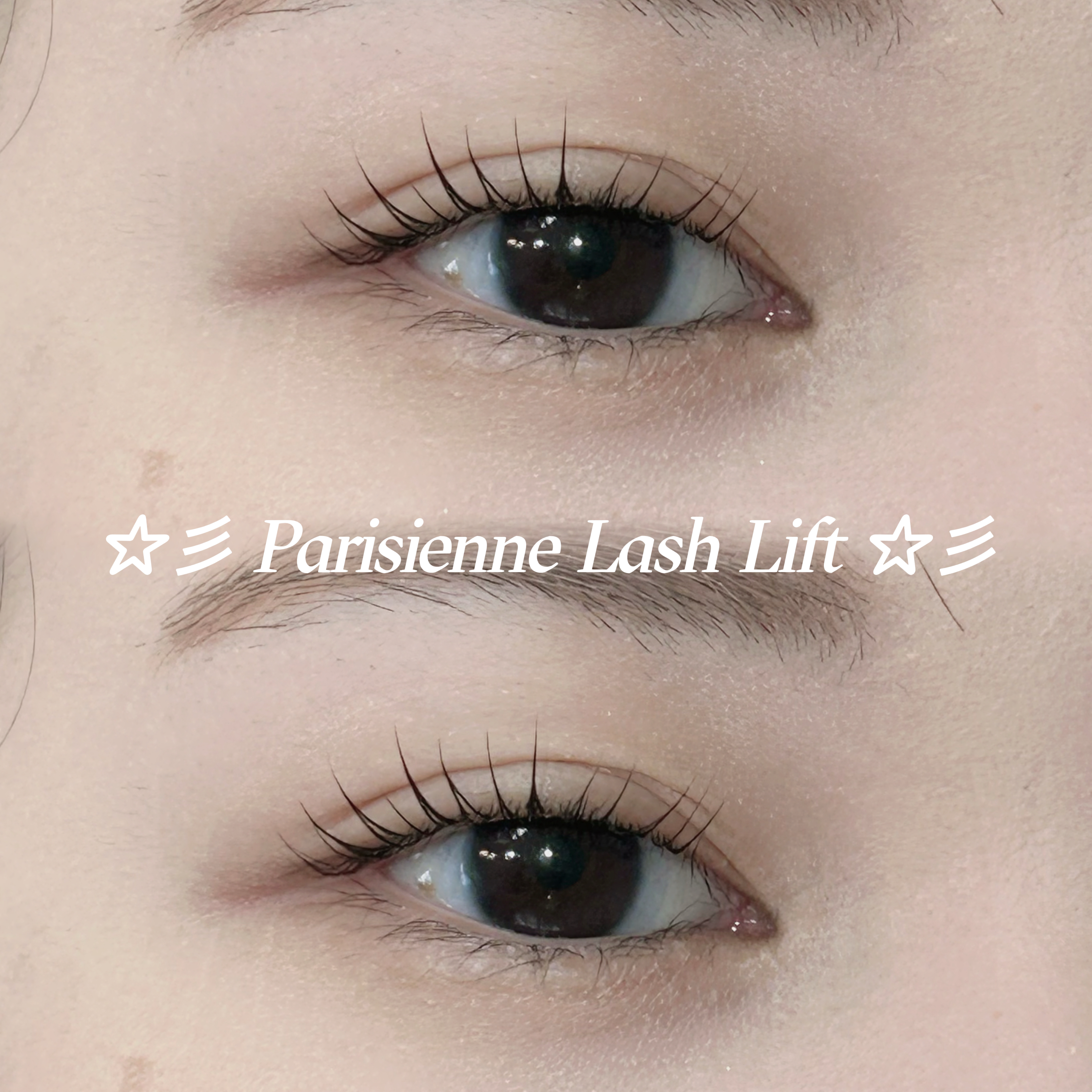 mio_trueye