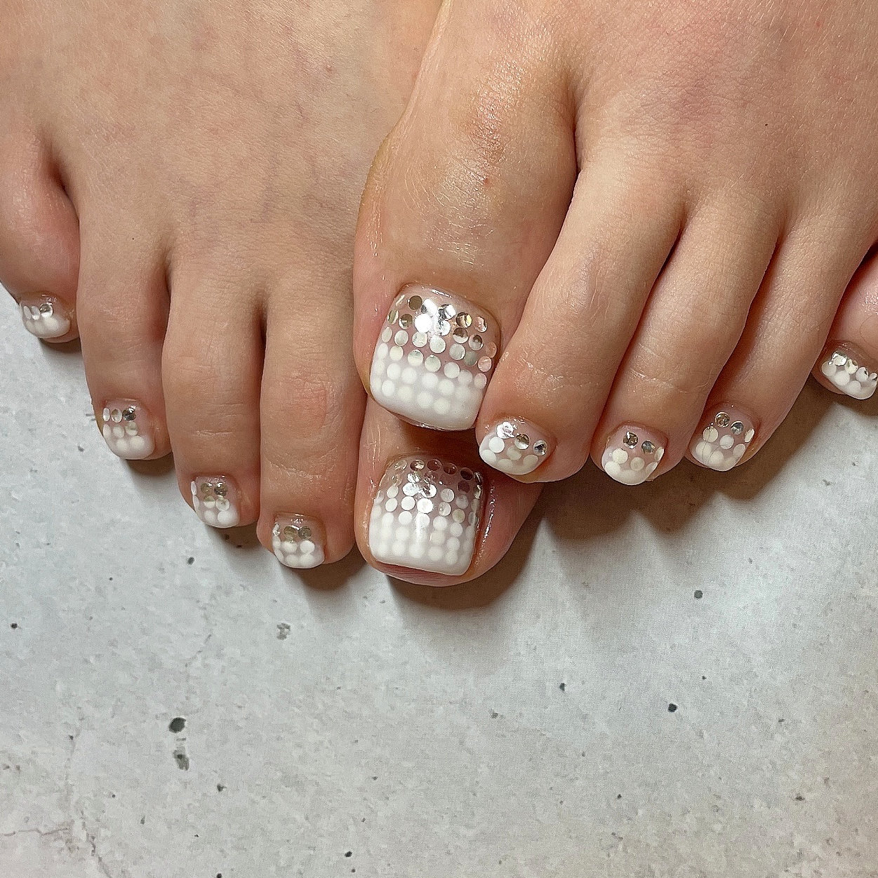 NAIL_akinyan