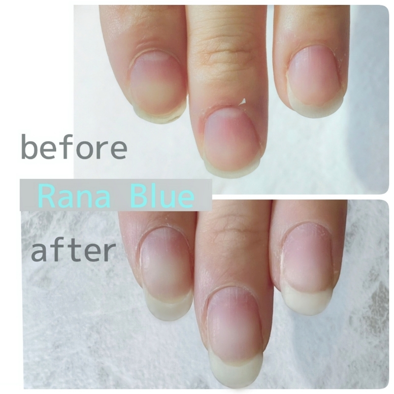 RanaBlue