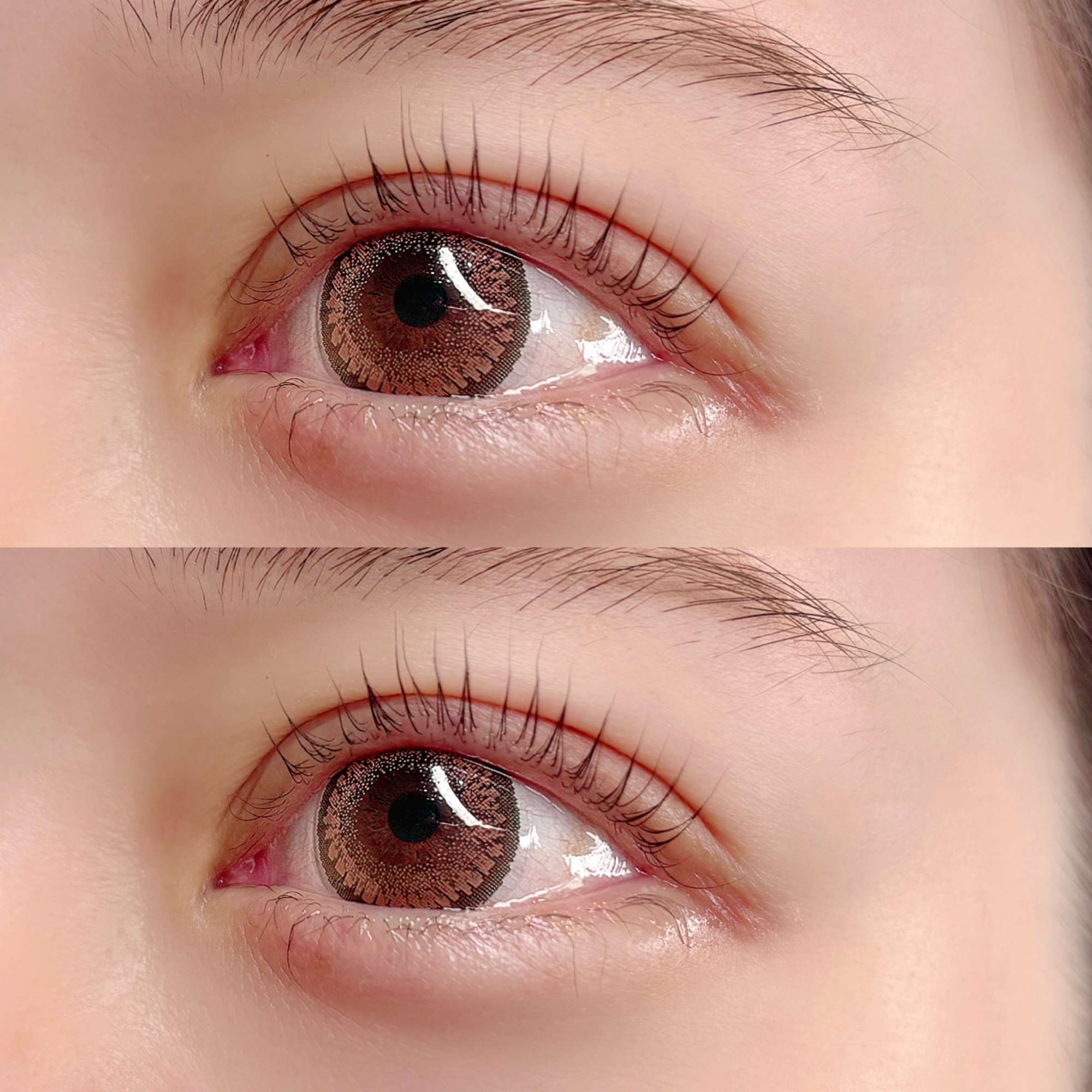 eye_misa