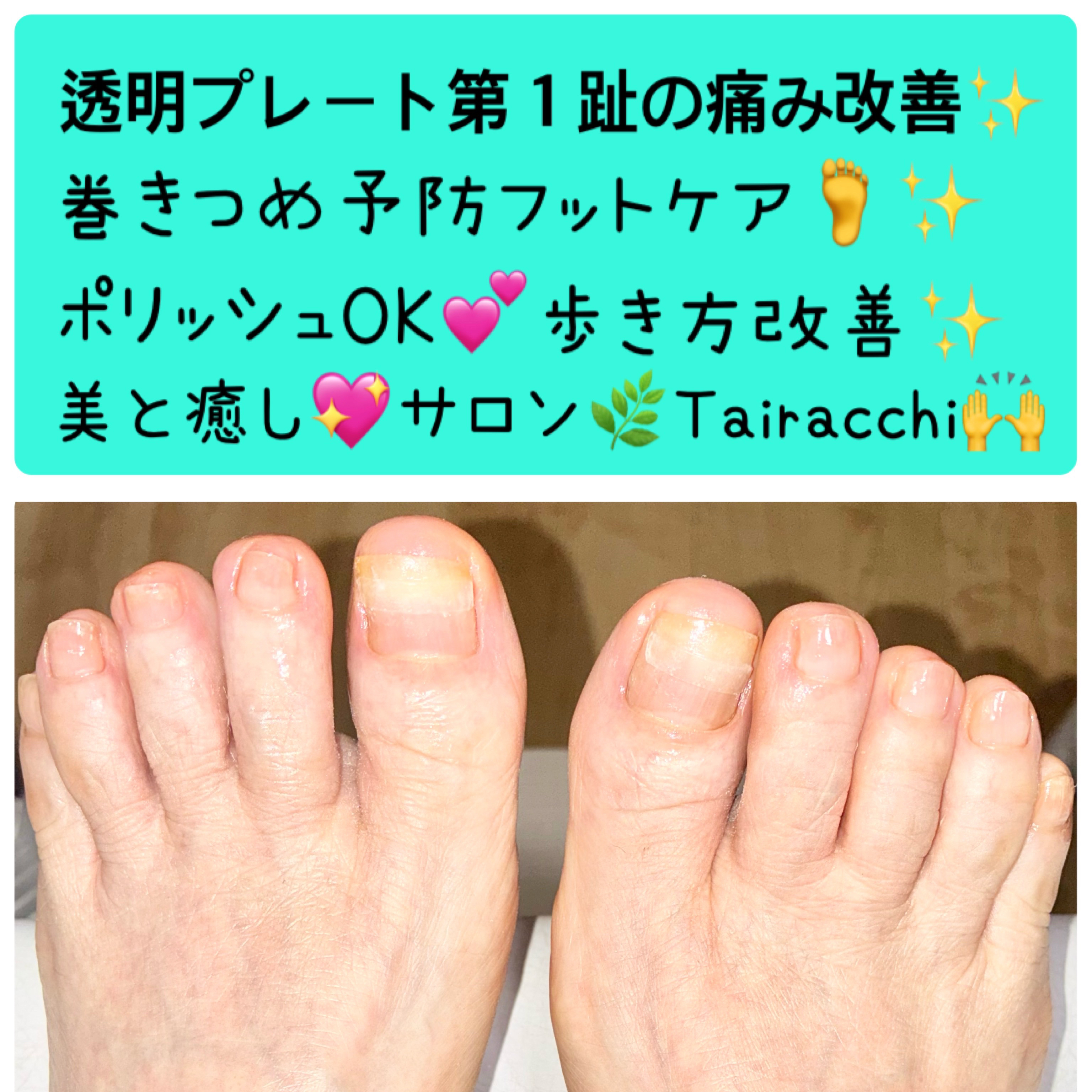 Tairacch_
