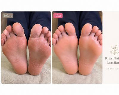 【フット角質除去.お爪のケア】本格ケアで足裏スベスベ