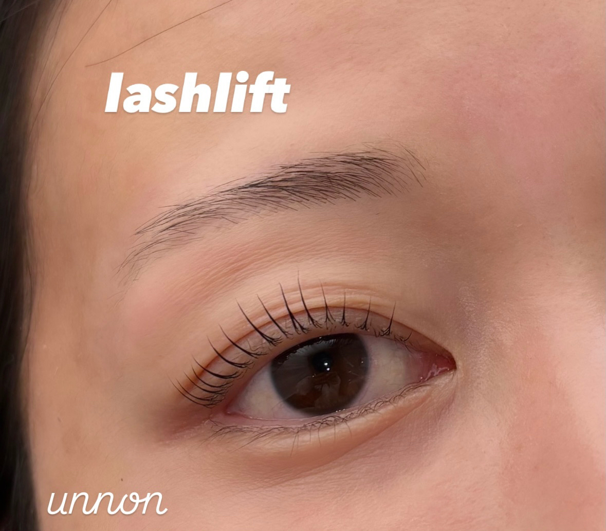 unnon_komabayashi