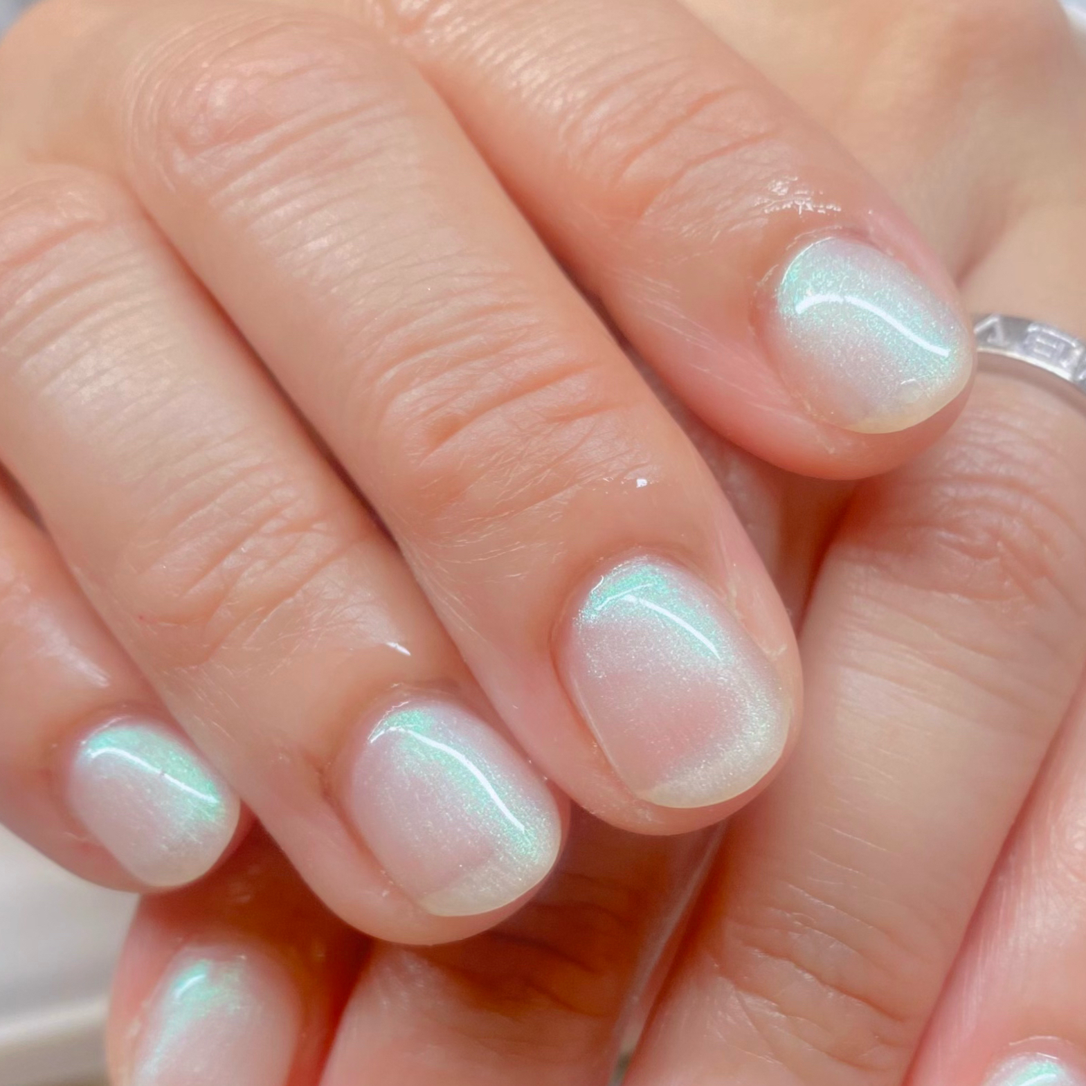 M_nail