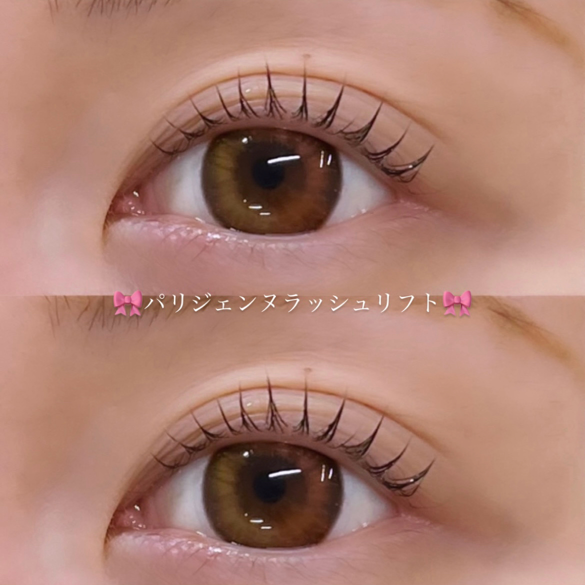 yukanida_trueye