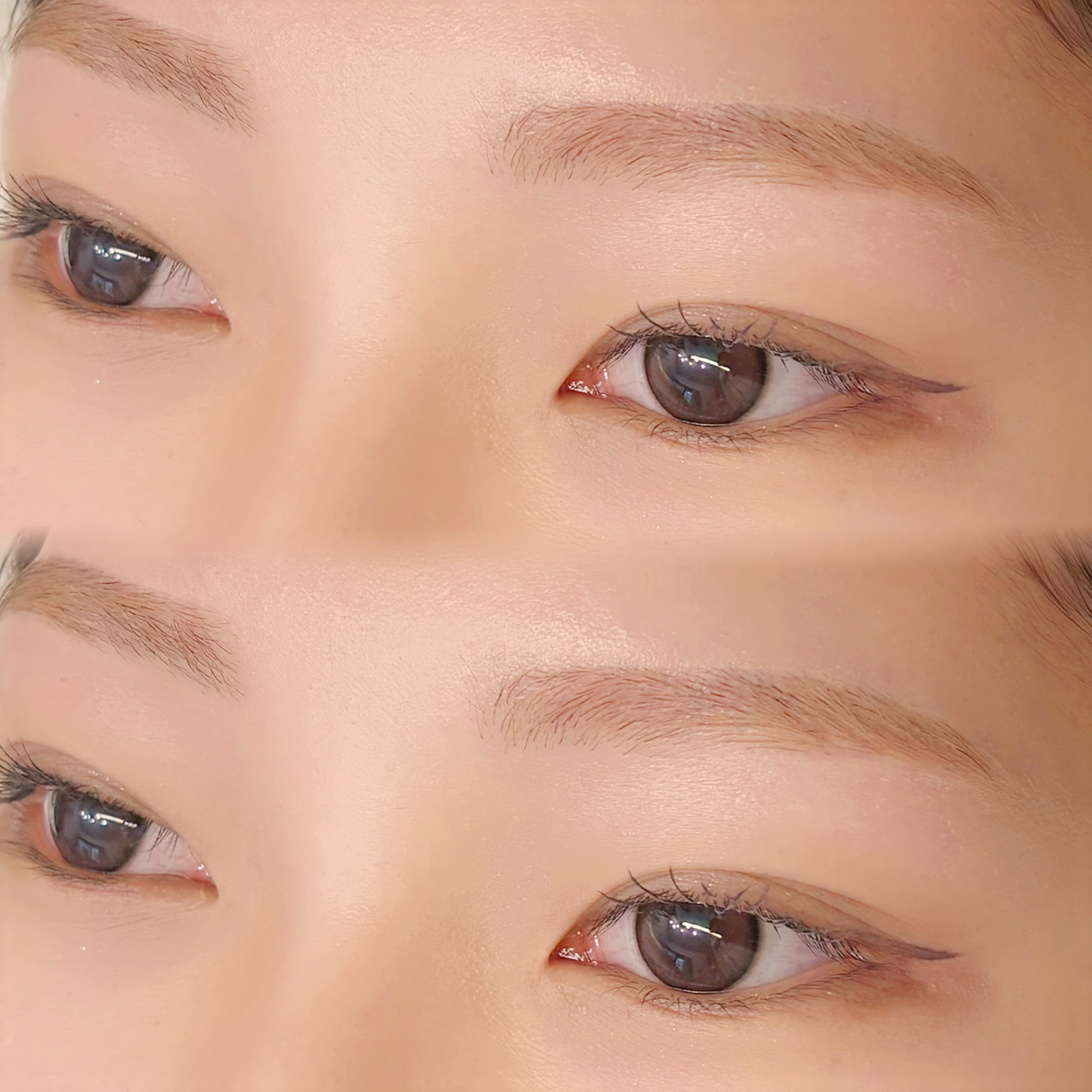 eye_nanane