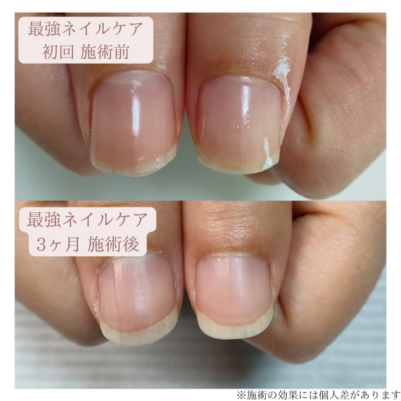 ca.nail