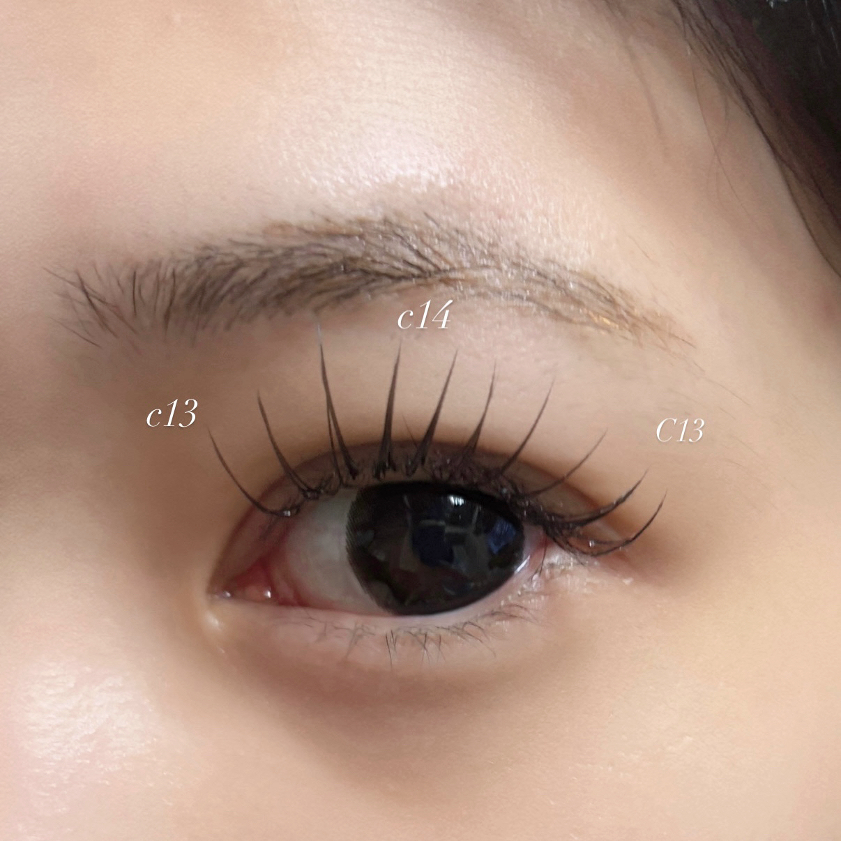 aoi__trueye