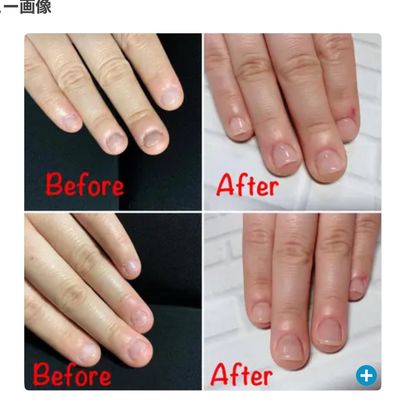 【深爪・育爪❤】伸ばす➕強化➕デコボコを　3ヶ月コース ツルンと美爪に💅🏻