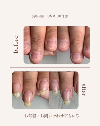 自爪育成（クリア/自然マット仕上げ）初回〜3回まで　※オイルプレゼント込み