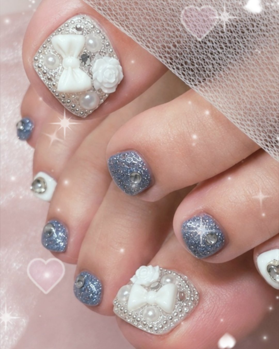 miliynail