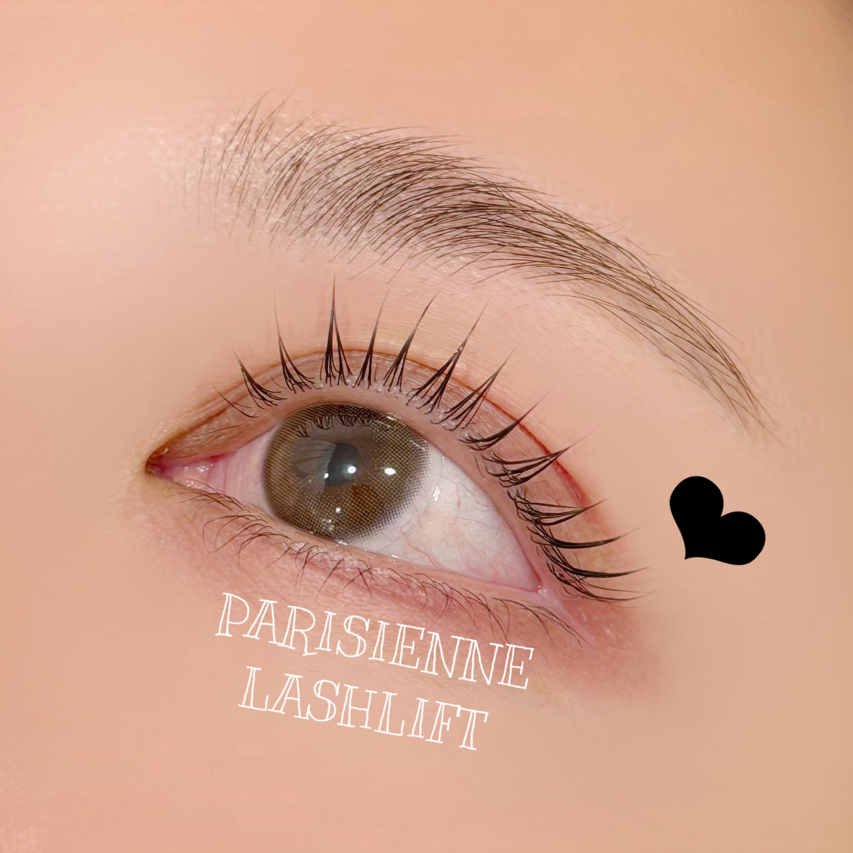 aoi_trueye