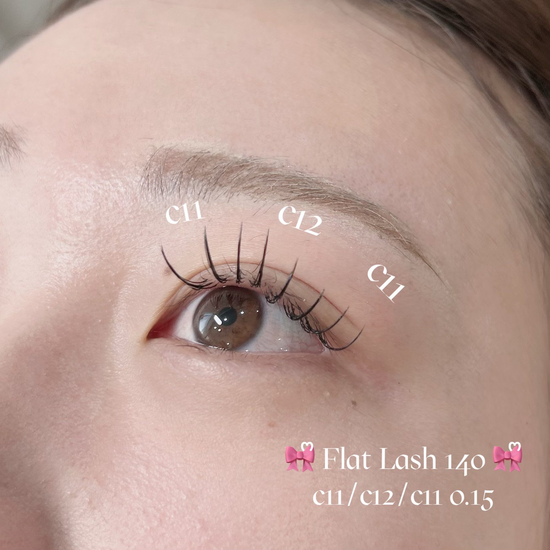 mio_trueye