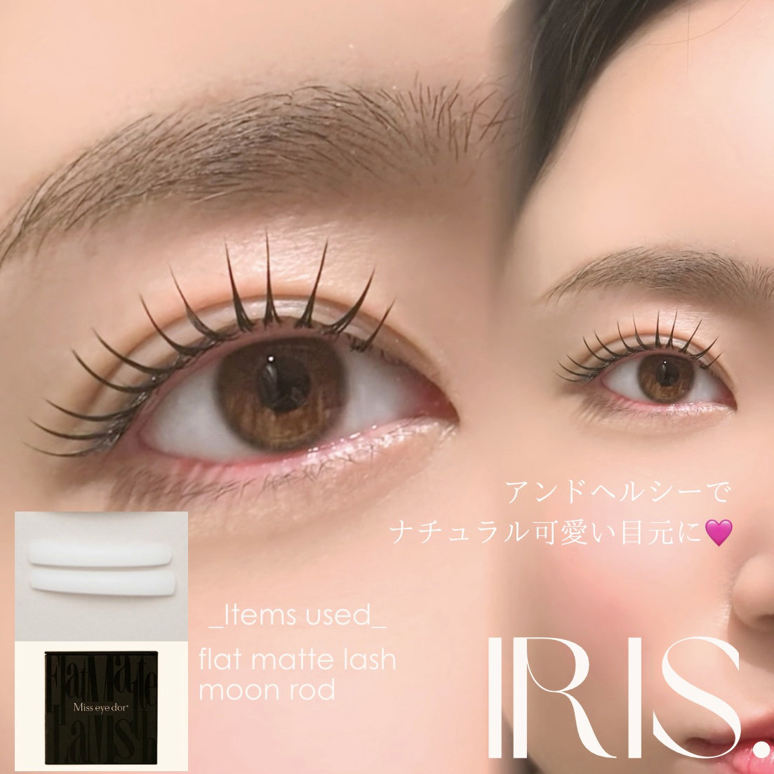 IRIS._rina