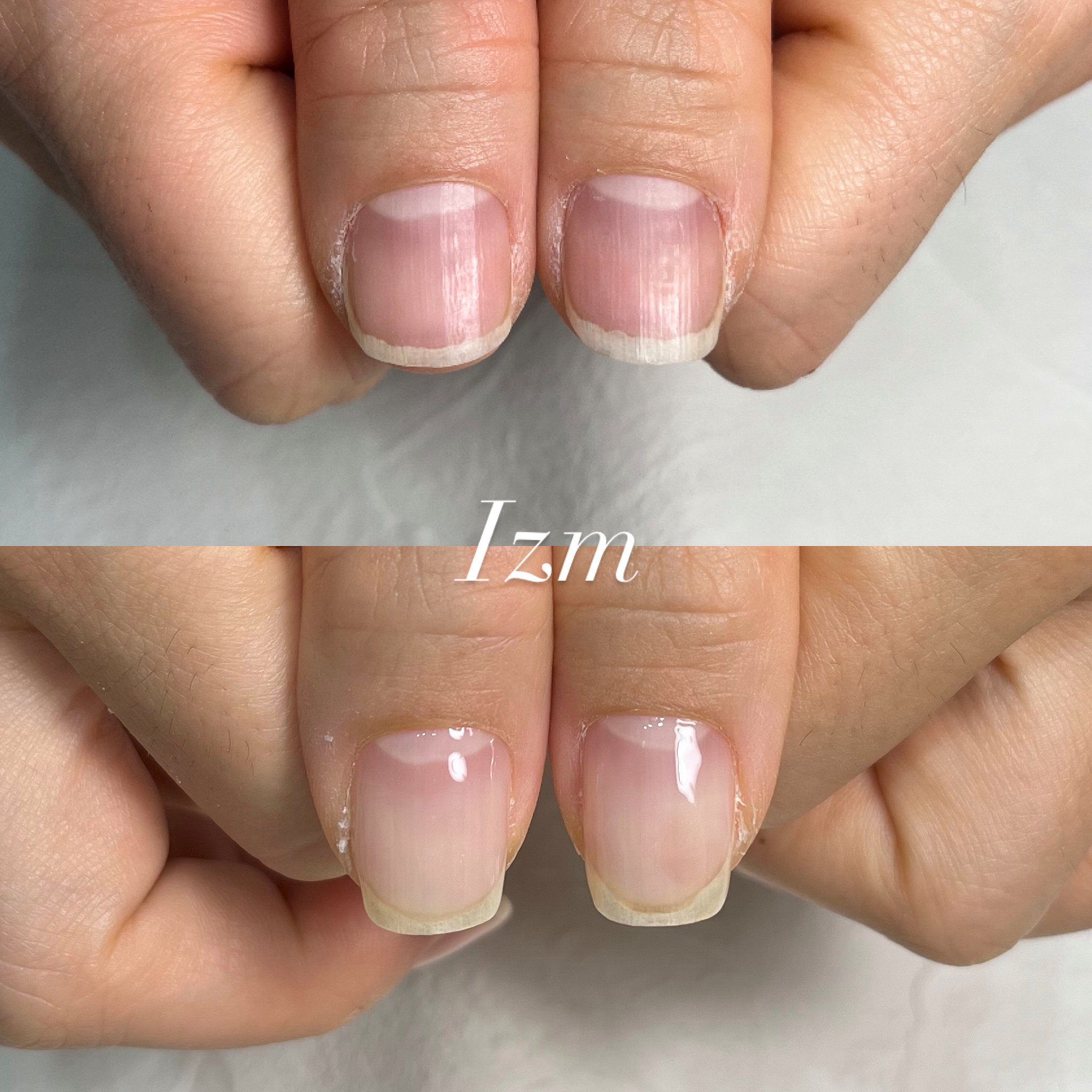 nail_izm