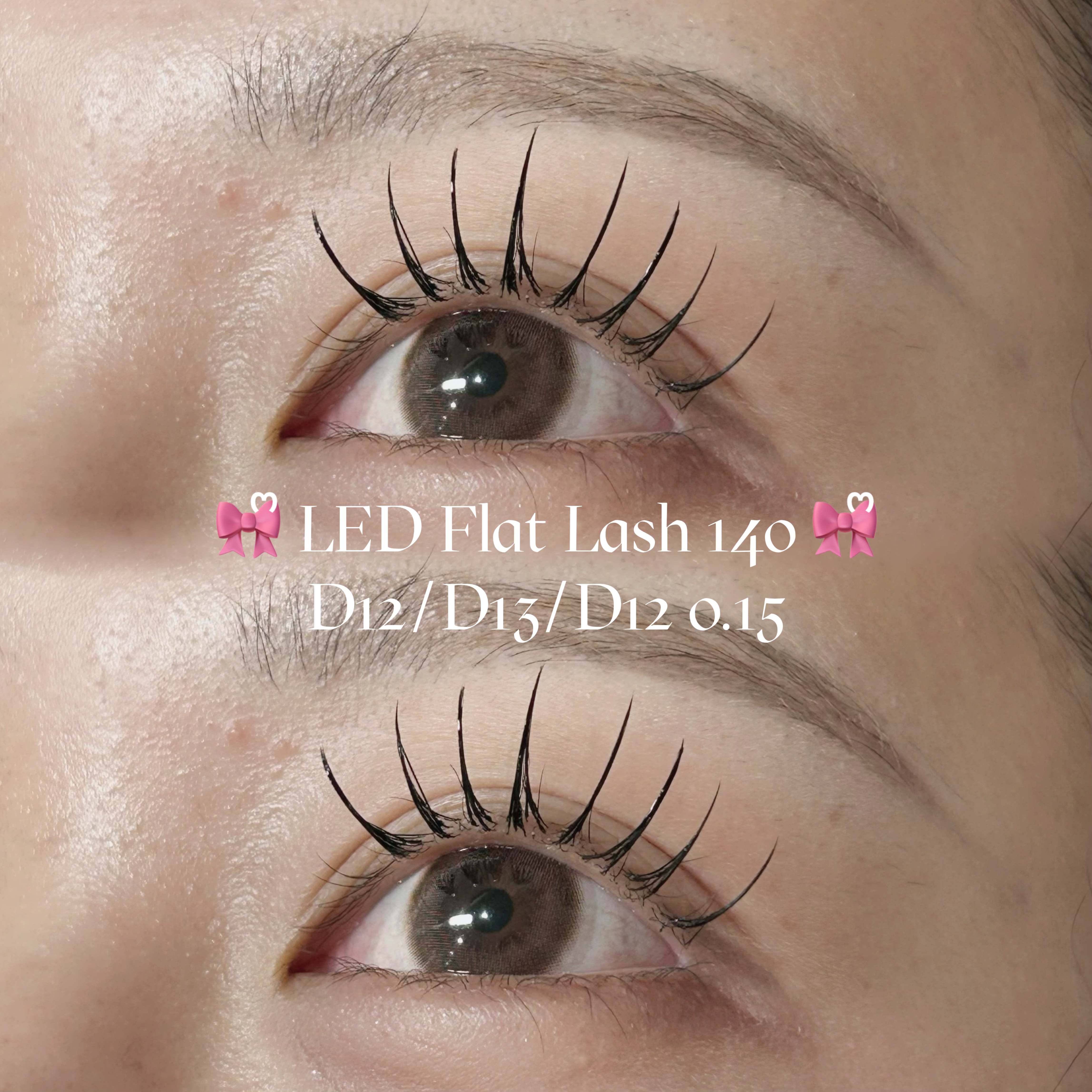 mio_trueye