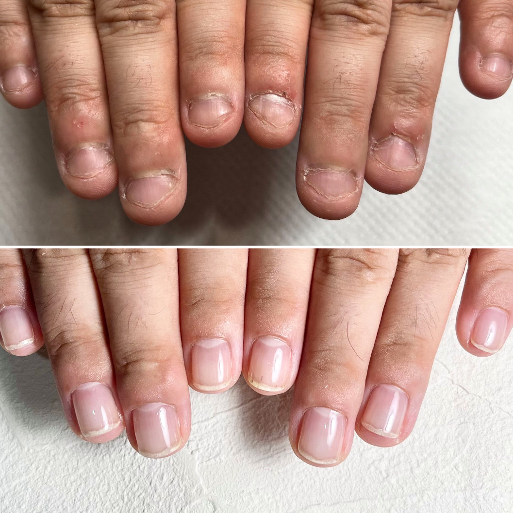 nail_izm